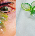 Mulher esqueceu de remover as lentes de contato e continuou colocando uma nova por 23 dias seguidos  Foto: Reprodução / Instagram @california_eye_associates