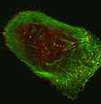 Célula de melanoma humano vista em microscópio confocal fluorescente de varredura a laser  Foto: Vira V. Artym/NIDC-NIH