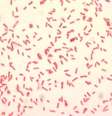 Sob uma ampliação de 1000X, imagem revela bactérias Yersinia pestis  Foto: Divulgação / CDC