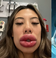 Basia Query, de Las Vegas, viraliza na internet após reação alérgica e é comparada com personagem de desenho  Foto: Reprodução/TikTok/@basiaquery/Twitter