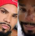 Naldo Benny, antes e depois  Foto: Reprodução Instagram