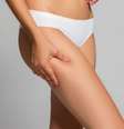 A celulite não é uma doença, mas incomoda muitas mulheres  Foto: Shutterstock / Alto Astral