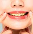 Alimentos amarelam dentes  Foto: Shutterstock / Alto Astral