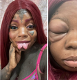 A jamaicana está acostumada a fazer modificações corporais, como bifurcação da língua e tatuagens, e compartilha seu estado de saúde através do TikTok  Foto: Reproução/ TikTok: @inkedup_britishjamaican1