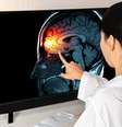 Alerta: sintomas comuns podem indicar meningite  Foto: Shutterstock / Saúde em Dia