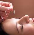 Acupuntura estética: conheça procedimento focado na beleza  Foto: Shutterstock / Saúde em Dia