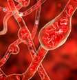 Nem todo aneurisma é cerebral; conheça os outros tipos  Foto: Shutterstock / Saúde em Dia