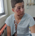 Jovem é agredido por pai e filho lutadores de MMA em bloco de carnaval  Foto: Reprodução/TV Globo