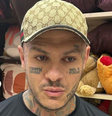 O influenciador fitness Tiago Toguro se envolveu em um acidente na madrugada deste sábado (04) em um movimentada via expressa do Rio de Janeiro.  Foto: Reprodução, Instagram / Purepeople