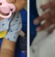 Bebê tem parte do dedo amputada após erro de enfermeira  Foto: Reprodução: Redes Sociais