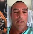 Paulo Zulu foi submetido a cirurgia e publicou vídeo nas redes sociais  Foto: Reprodução/Instagram