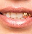 Dentes de ouro exigem cuidado e acompanhamento especializado -  Foto: Shutterstock / Alto Astral