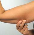 Anticoncepcionais causam flacidez muscular? Entenda o motivo -  Foto: Shutterstock / Saúde em Dia