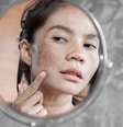 O melasma não oferece riscos à saúde, mas impacta a autoestima -  Foto: Shutterstock / Alto Astral