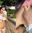 Chip da beleza: o implante hormonal realmente funciona? Entenda -  Foto: Reprodução Instagram (@flay) / Saúde em Dia