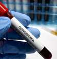 Gonorreia é uma infecção sexualmente transmissível  Foto: Hailshadow / iStock