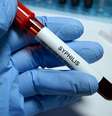 Imagem meramente ilustrativa de uma amostra de sangue com sífilis  Foto: iStock