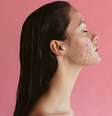 O “chip da beleza” pode causar efeitos indesejados como a acne -  Foto: Shutterstock / Alto Astral