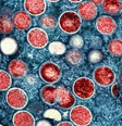  Foto: National Institute of Allergy and Infectious Diseases/NIAID / Canaltech
