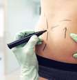 Cirurgia devolve autoestima após o parto: o que é o mommy makeover? -  Foto: Shutterstock / Saúde em Dia