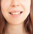 As manchas nos dentes são causadas por diversos fatores -  Foto: Shutterstock / Alto Astral