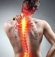 Escoliose é uma doença na coluna vertebral  Foto: RomarioIen| Shutterstock / Portal EdiCase