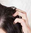A caspa e dermatite seborreica têm causas e tratamentos diferentes -  Foto: Shutterstock / Alto Astral