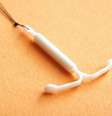 O DIU é um método contraceptivo que apresenta diversas vantagens -  Foto: Shutterstock / Alto Astral