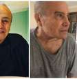 Stenio Garcia antes e dias após harmonização facial  Foto: Reprodução/ Instagram @steniogarciaoficial | Arquivo pessoal