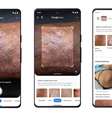 Google Lens pode ajudar pacientes a identificar doenças de pele  Foto: Divulgação/Google