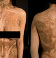  Foto: Bygum et al./BMC Medical Genetics / Canaltech