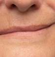 Saiba quais são as causas e o tratamento para a paralisia facial -  Foto: Shutterstock / Alto Astral