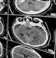 Traumatismo craniano: saiba como é o tratamento e recuperação do paciente -  Foto: Shutterstock / Saúde em Dia