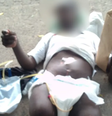 Homem sem pernas e com sonda é deixado em calçada de hospital que estava internado  Foto: Reprodução/Redes Sociais
