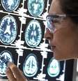 Médica olhando exames de cérebro  Foto: Getty Images / BBC News Brasil