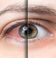 Sintomas da síndrome do olho seco pioram em julho; veja como prevenir -  Foto: Shutterstock / Saúde em Dia