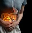 Alimentos que aumentam risco de câncer no intestino -  Foto: Shutterstock / Saúde em Dia