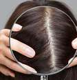 O couro cabeludo precisa de cuidado também -  Foto: Shutterstock / Alto Astral