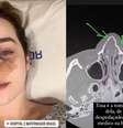 Estela Frohlich foi encaminhada para um hospital particular.  Foto: Reprodução/Redes sociais / Perfil Brasil