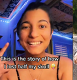 Natasha Santana contou com detalhes como passou pelas cirurgias de retirada de crânio  Foto: Reprodução/TikTok