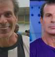 Resultado harmonização –  Foto: Reprodução Fofocalizando / SBT / Famosos e Celebridades