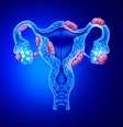 Endometriose pode ser causada por bactérias, revela estudo -  Foto: Shutterstock / Saúde em Dia