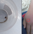 Menino de 8 anos é picado por viúva negra ao tentar virar Homem-Aranha  Foto: Reprodução/Redes Sociais 