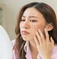 Por que o inverno é a melhor época para tratar o melasma? Entenda -  Foto: Shutterstock / Saúde em Dia