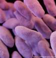 Pesquisa mostrou que resistência a antibióticos pode aumentar 17% até 2050 se a poluição do ar não for combatida de forma eficaz  Foto: DW / Deutsche Welle