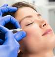 O procedimento envolve a injeção cuidadosa de ácido hialurônico na área das olheiras  Foto: hedgehog94 | Shutterstock / Portal EdiCase