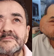José Nilton Cardozo tomava 18 doses de morfina ao dia para lidar com dores do tumor  Foto: Arquivo Pessoal