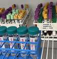 tubos de laboratório  Foto: QVIN / BBC News Brasil