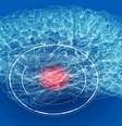 Alerta: dor de cabeça sem melhora pode indicar aneurisma cerebral -  Foto: Shutterstock / Saúde em Dia
