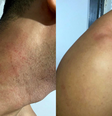 Fã denuncia que foi enforcado por seguranças durante show de Gusttavo Lima em Goiânia.  Foto: Reprodução/Arquivo Pessoal / Reprodução/Arquivo Pessoal
